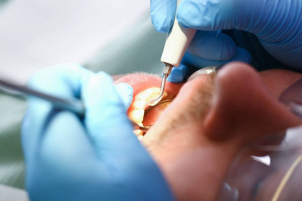 Best Emergency Root Canal Treatment in Corry, PA